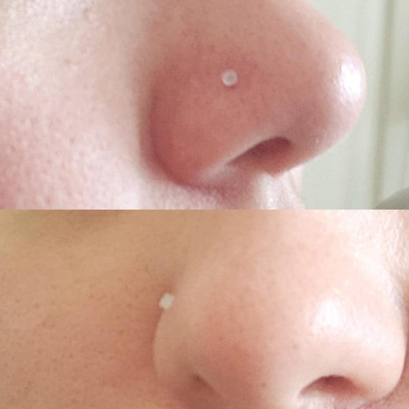 MODRSA 18g 20g Clear Nose Rings Retainer L-shaped Nose Studs Screw Flexible Flesh Skin Color CZ Gem High Nostril Pin Bone Flat Top Small Nose Piercing Retainer for Work Surgery 7mm bar - Image 5